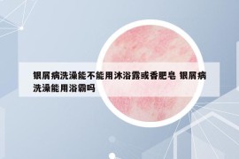 銀屑病洗澡能不能用沐浴露或香肥皂 銀屑病洗澡能用浴霸嗎
