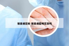 銀屑病花粉 銀屑病能喝花茶嗎