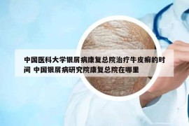 中國醫(yī)科大學銀屑病康復總院治療牛皮癬的時間 中國銀屑病研究院康復總院在哪里