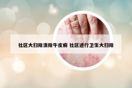 社區(qū)大掃除清除牛皮癬 社區(qū)進(jìn)行衛(wèi)生大掃除