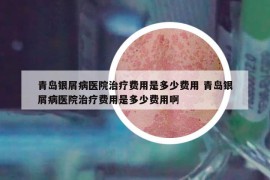 青島銀屑病醫(yī)院治療費用是多少費用 青島銀屑病醫(yī)院治療費用是多少費用啊