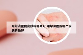 哈爾濱醫(yī)院皮膚科哪家好 哈爾濱醫(yī)院哪個(gè)皮膚科最好