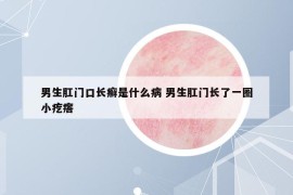 男生肛門口長癬是什么病 男生肛門長了一圈小疙瘩