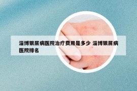 淄博銀屑病醫(yī)院治療費(fèi)用是多少 淄博銀屑病醫(yī)院排名