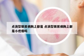 點(diǎn)滴型銀屑病胸上都是 點(diǎn)滴型銀屑病胸上都是小疙瘩嗎
