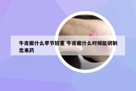 牛皮廨什么季節(jié)較重 牛皮廨什么時(shí)候能研制出來藥