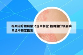 福州治療銀屑病只選中和堂 福州治療銀屑病只選中和堂醫(yī)生