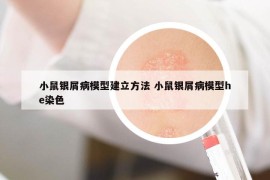 小鼠銀屑病模型建立方法 小鼠銀屑病模型he染色