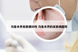 烏魯木齊皮膚病診所 烏魯木齊的皮膚病醫(yī)院