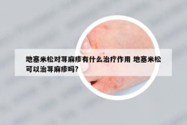 地塞米松對蕁麻疹有什么治療作用 地塞米松可以治蕁麻疹嗎?