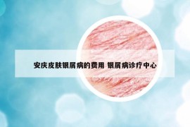 安慶皮膚銀屑病的費(fèi)用 銀屑病診療中心