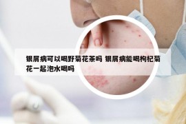 銀屑病可以喝野菊花茶嗎 銀屑病能喝枸杞菊花一起泡水喝嗎