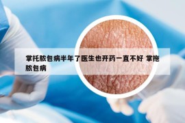 掌托膿包病半年了醫(yī)生也開(kāi)藥一直不好 掌拖膿包病