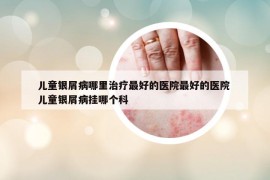 兒童銀屑病哪里治療最好的醫(yī)院最好的醫(yī)院 兒童銀屑病掛哪個(gè)科