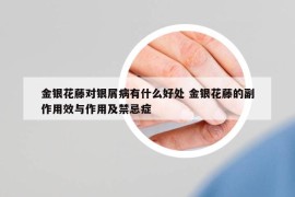 金銀花藤對銀屑病有什么好處 金銀花藤的副作用效與作用及禁忌癥