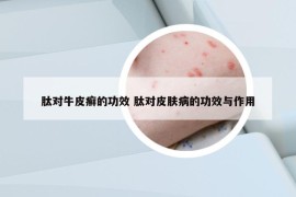 肽對牛皮癬的功效 肽對皮膚病的功效與作用