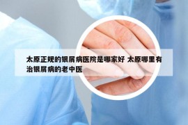 太原正規(guī)的銀屑病醫(yī)院是哪家好 太原哪里有治銀屑病的老中醫(yī)