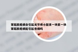 掌跖膿皰病會引起關(guān)節(jié)疼小腿青一塊紫一塊 掌跖膿皰病能引起骨病嗎