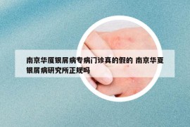 南京華廈銀屑病專(zhuān)病門(mén)診真的假的 南京華夏銀屑病研究所正規(guī)嗎