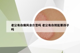 老公有白癜風(fēng)會(huì)介意嗎 老公有白斑能要孩子嗎