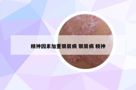 精神因素加重銀屑病 銀屑病 精神