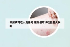 銀屑病可吃火龍果嗎 銀屑病可以吃番茄火鍋嗎