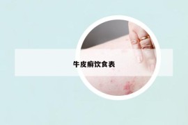 牛皮癬飲食表