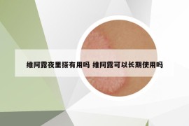 維阿露夜里搽有用嗎 維阿露可以長(zhǎng)期使用嗎