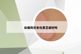 白癜風(fēng)飲食吃黑芝麻好嗎
