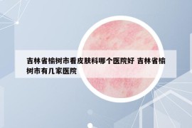 吉林省榆樹市看皮膚科哪個(gè)醫(yī)院好 吉林省榆樹市有幾家醫(yī)院