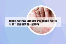 酮康唑洗劑和二硫化硒哪個好 酮康唑洗劑可以和二硫化硒洗劑一起用嗎