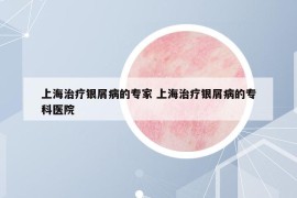 上海治療銀屑病的專家 上海治療銀屑病的?？漆t(yī)院