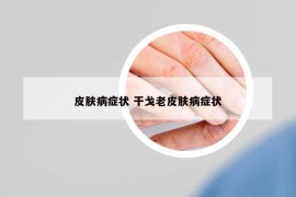 皮膚病癥狀 干戈老皮膚病癥狀