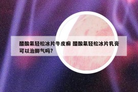 醋酸氟輕松冰片牛皮癬 醋酸氟輕松冰片乳膏可以治腳氣嗎?