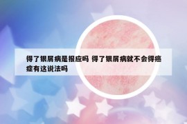 得了銀屑病是報應嗎 得了銀屑病就不會得癌癥有這說法嗎