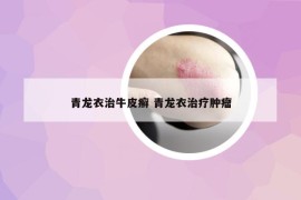 青龍衣治牛皮癬 青龍衣治療腫瘤
