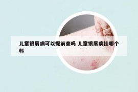兒童銀屑病可以提前查嗎 兒童銀屑病掛哪個(gè)科
