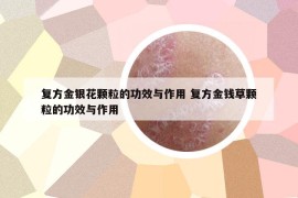 復(fù)方金銀花顆粒的功效與作用 復(fù)方金錢草顆粒的功效與作用