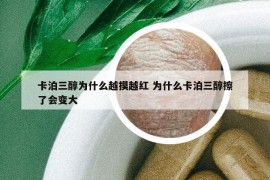 卡泊三醇為什么越摸越紅 為什么卡泊三醇擦了會(huì)變大