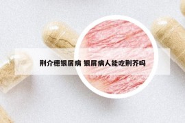 荊介穗銀屑病 銀屑病人能吃荊芥嗎