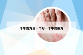 千年古方治一個(gè)好一個(gè)牛皮癬方