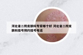 河北省二院皮膚科專家哪個(gè)好 河北省二院皮膚科掛號(hào)預(yù)約掛號(hào)電話