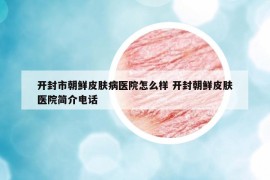開封市朝鮮皮膚病醫(yī)院怎么樣 開封朝鮮皮膚醫(yī)院簡介電話