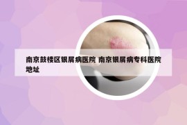 南京鼓樓區(qū)銀屑病醫(yī)院 南京銀屑病?？漆t(yī)院地址