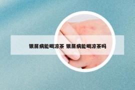 銀屑病能喝涼茶 銀屑病能喝涼茶嗎
