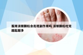 服用消銀顆粒會出現(xiàn)副作用嗎 消銀顆粒吃完越起越多