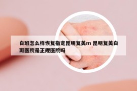 白班怎么樣恢復(fù)指定昆明復(fù)美m(xù) 昆明復(fù)美白斑醫(yī)院是正規(guī)醫(yī)院嗎