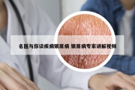 名醫(yī)與你談疾病銀屑病 銀屑病專家講解視頻