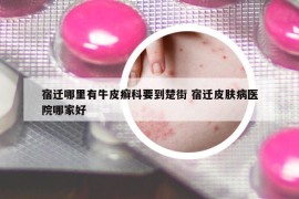 宿遷哪里有牛皮癬科要到楚街 宿遷皮膚病醫(yī)院哪家好