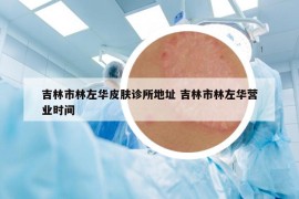 吉林市林左華皮膚診所地址 吉林市林左華營(yíng)業(yè)時(shí)間